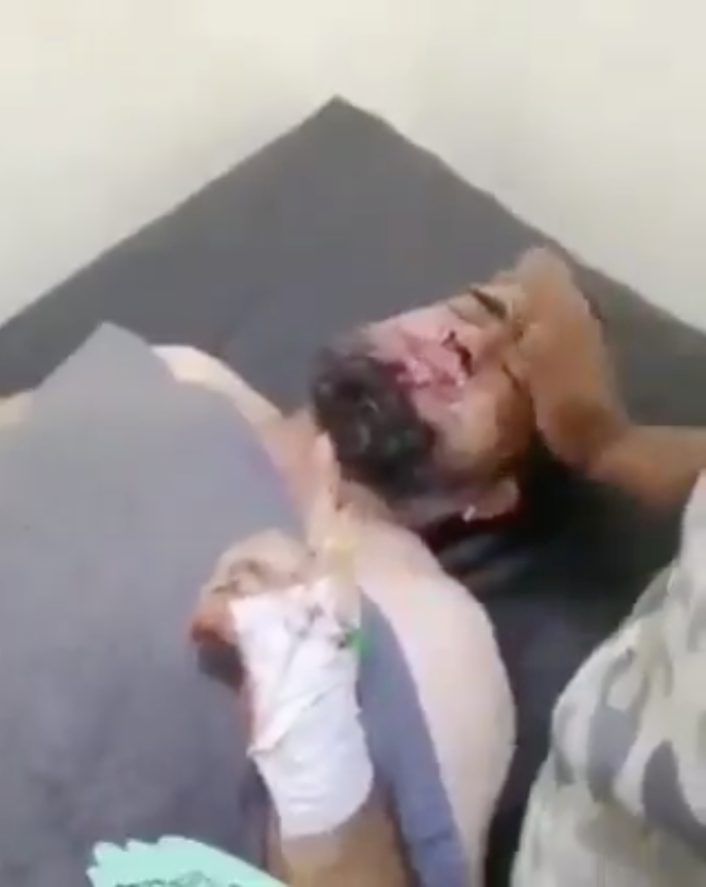 Syrian Militant Injured in Azerbaijan warns Fellow mercenaries Not to Come to Azerbaijan.